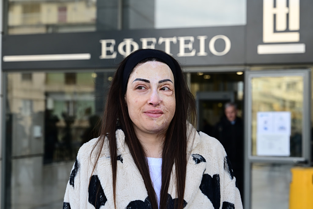 Κανείς δεν περίμενε τη συγκλονιστική εξομολόγηση της Ιωάννας Παλιοσπύρου έξι χρόνια μετά την επίθεση με βιτριόλι – Το μήνυμα ζωής που συγκίνησε όλη την Ελλάδα - NewsPoint.gr