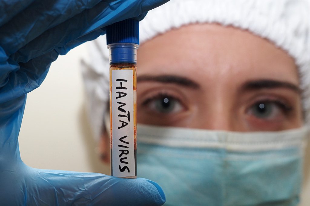 Ο φόβος για τον ιό Hantaan επέστρεψε – Τι πραγματικά συμβαίνει και ποιος είναι ο κίνδυνος για την Ελλάδα; 1 Ο φόβος για τον ιό Hantaan επέστρεψε – Τι πραγματικά συμβαίνει και ποιος είναι ο κίνδυνος για την Ελλάδα; - NewsPoint.gr